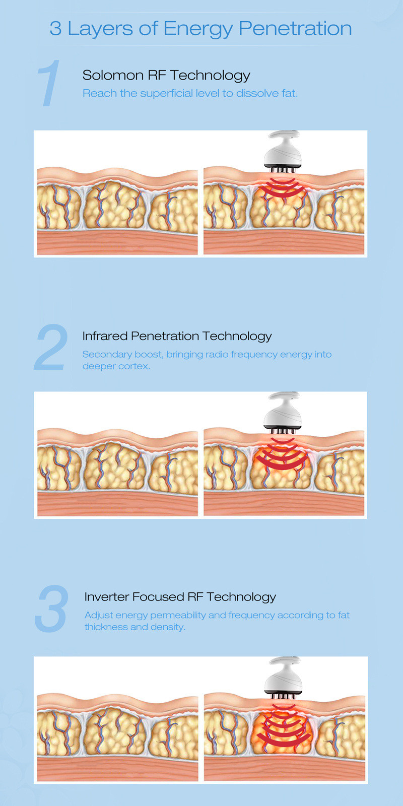 Chinese Wholesale China Israel Technology RF Fractional Gold RF Microneedle (