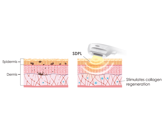 SDPL TECHNOLOGY