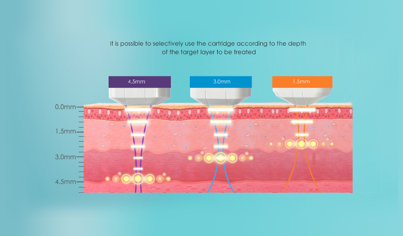 Functions of Different Cartridges